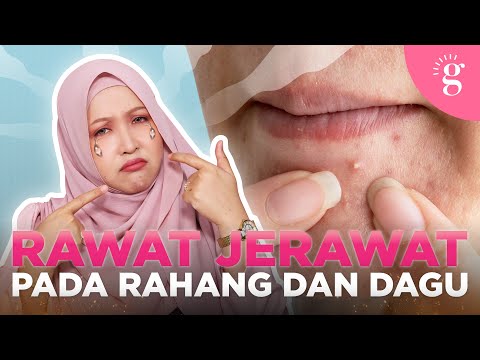 Video: Bagaimana untuk mengelakkan jerawat di leher selepas bercukur?