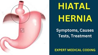 What is Hiatal Hernia| Medical coding for beginners |Medical coding course | Anatomy and physiology