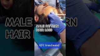 Hair Loss Treatment with PRP and GFC at Myra skin and hair solutions , Delhi