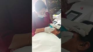 #Microneedling #SkinRejuvenation #GlowingSkin #HealthySkin #AcneScars #SkinCareRoutine #DermaCare #