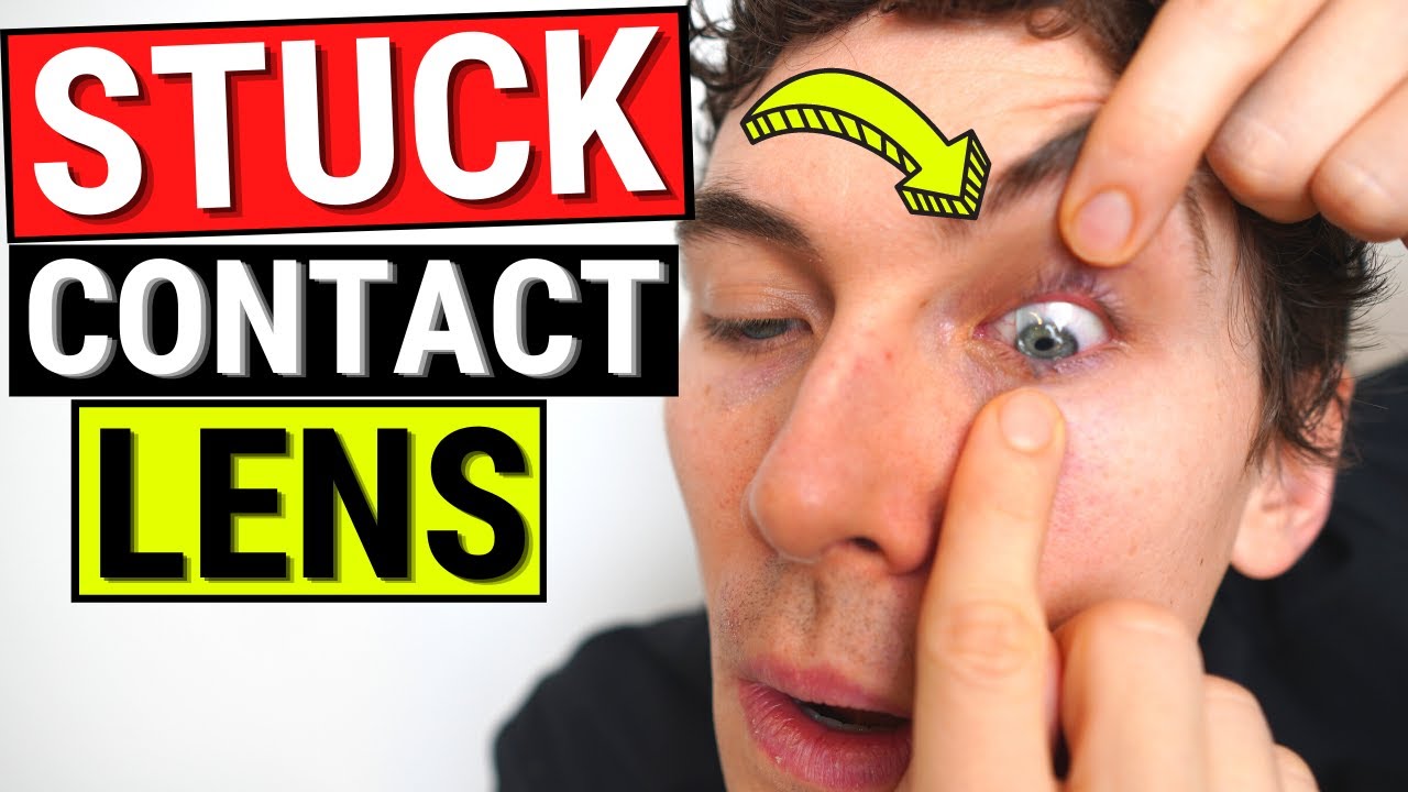 How to Remove a STUCK Contact Lens from the Eye - YouTube