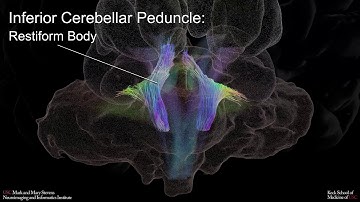 A probabilistic atlas of human brainstem pathways based on connectome imaging data