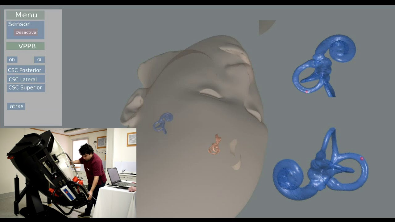 Simvest SimVest Med sobre silla TRV, Maniobra de EPLEY. Vestibular Simulator ...