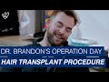 Hair transplantation full procedure  brandons operation day