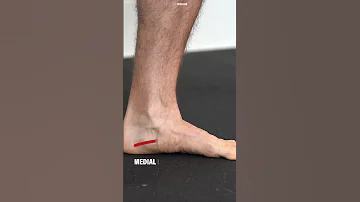 Tibialis Posterior Anatomy & Function #shorts