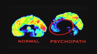 Inside a Killer’s Brain?; Diva Makeover After Divorce!; Jewelry for Weight Loss? screenshot 5