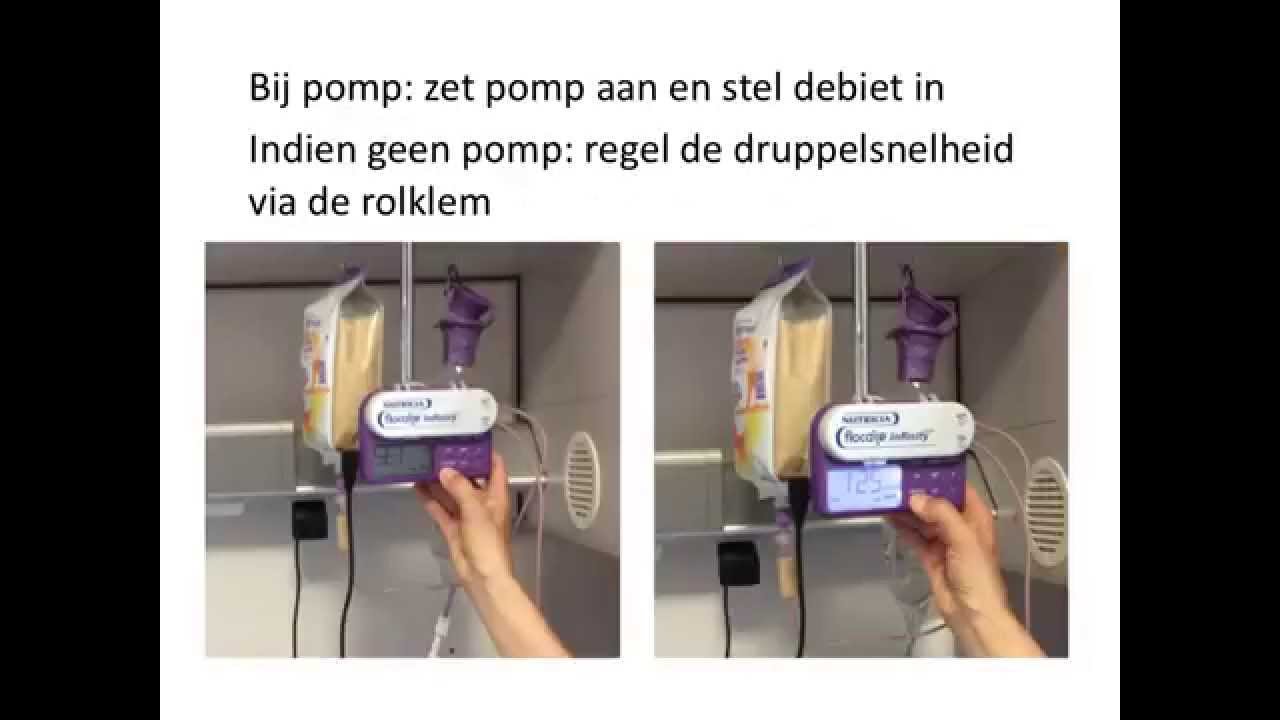 sondevoeding thuis