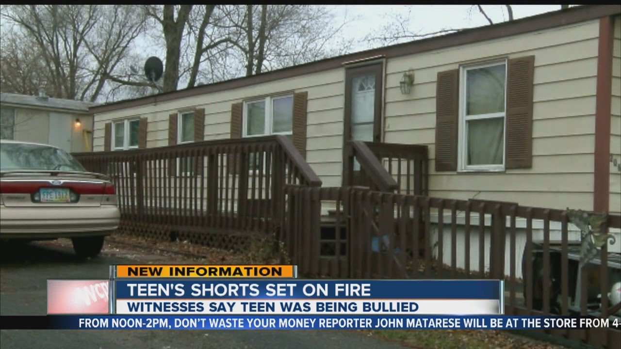 Deputies: Teen set sleeping boy's shorts on fire