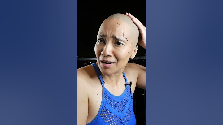 #shorts | ladki ne karaya 7th baar takla 😁 | #richakharb #bald #baldgirl #fashion