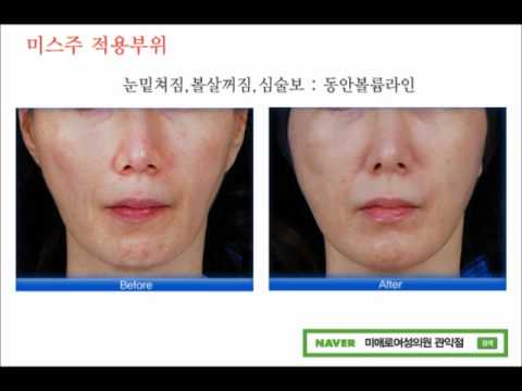 미스주 MisJu