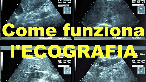 Come viene fatta un'ecografia?