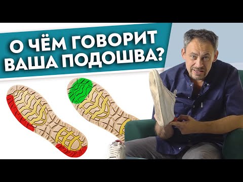 Видео: Проблемы с пронацией - Как исправить продвинутые ступни