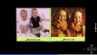 مقر المعلومات الوراثية (البرنامج الوراثي) و التوائم