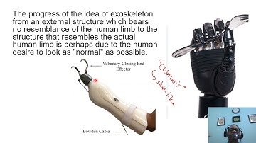 Lecture Orthosis 1 video