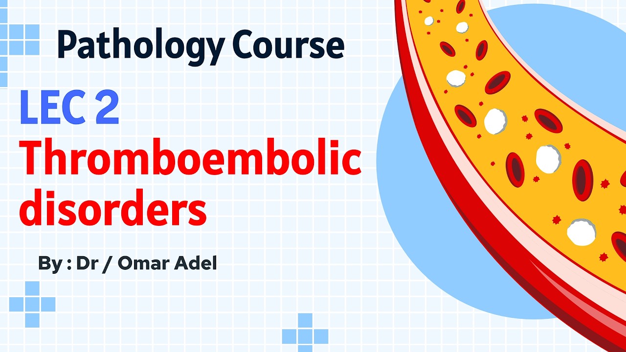 LEC 2 _  Pathology _  Thromboembolic disorders _ المحاضرة الثانية _ باثولوجى