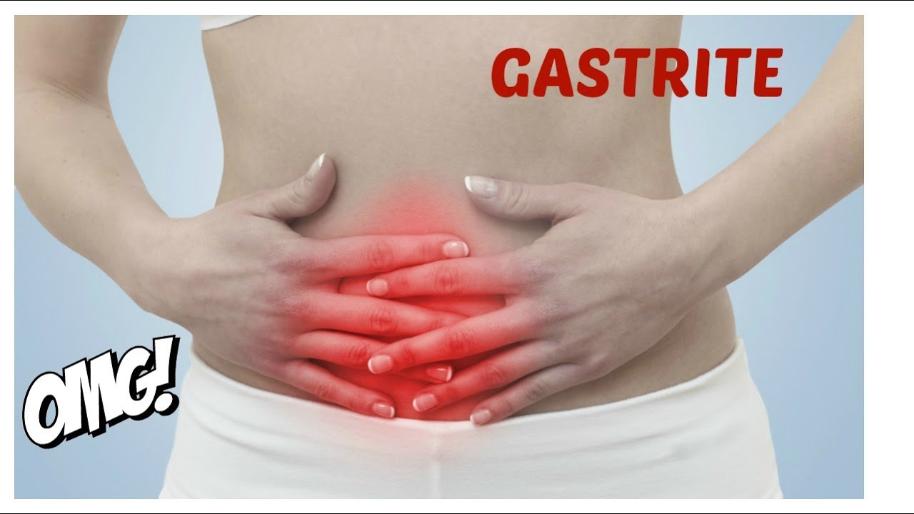 Gastrite Enantematosa Leve De Antro O Que Comer