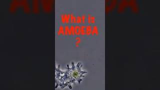 What Is Amoeba And Why Is It Special?
