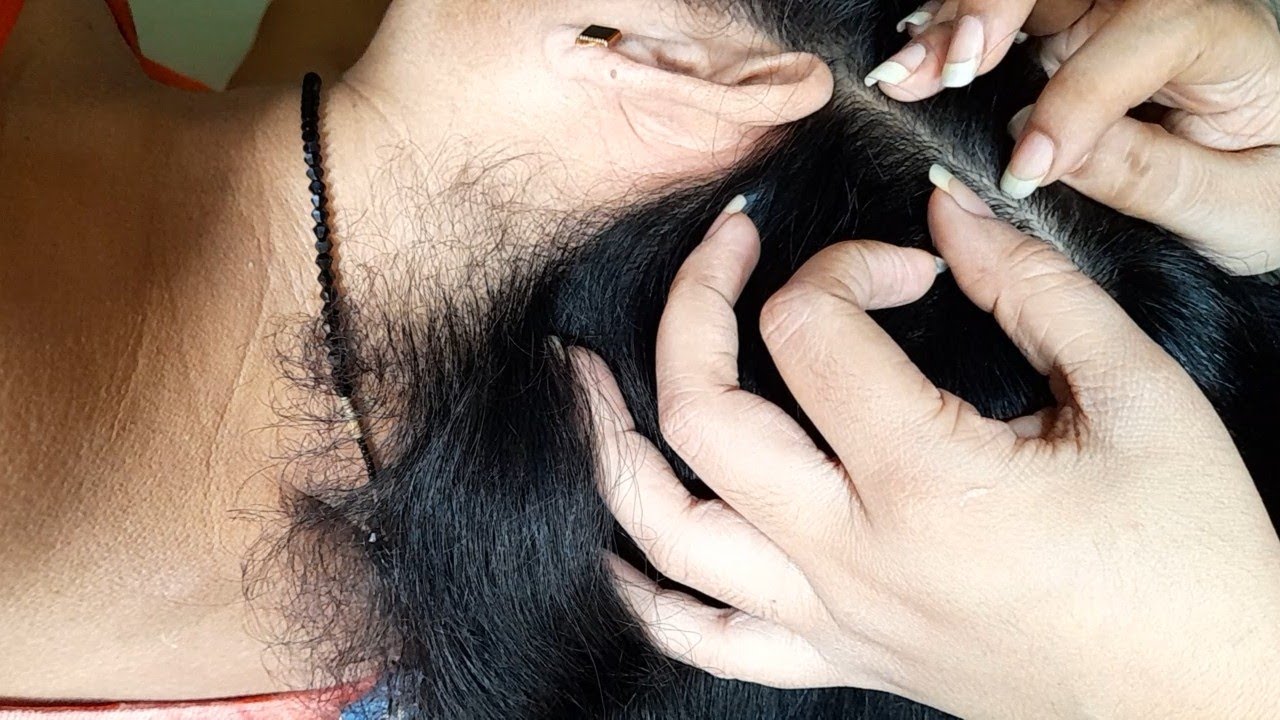 😊🌜 Removing white hair | Scalp checking | Caricutu | Full concentration scalp tick removal