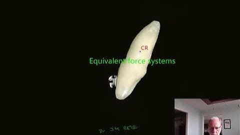 Force system  in orthodontic tooth movement