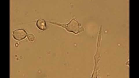 Human T lymphoma cells migrating on ICAM-1. HUT78