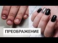 Наращивание ДЕФОРМИРОВАННЫХ ногтей/ Сложное наращивание/ ANKO NAIL