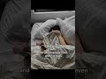 Morning face = night problem #fyp #usa #viral #sleep #sponsored