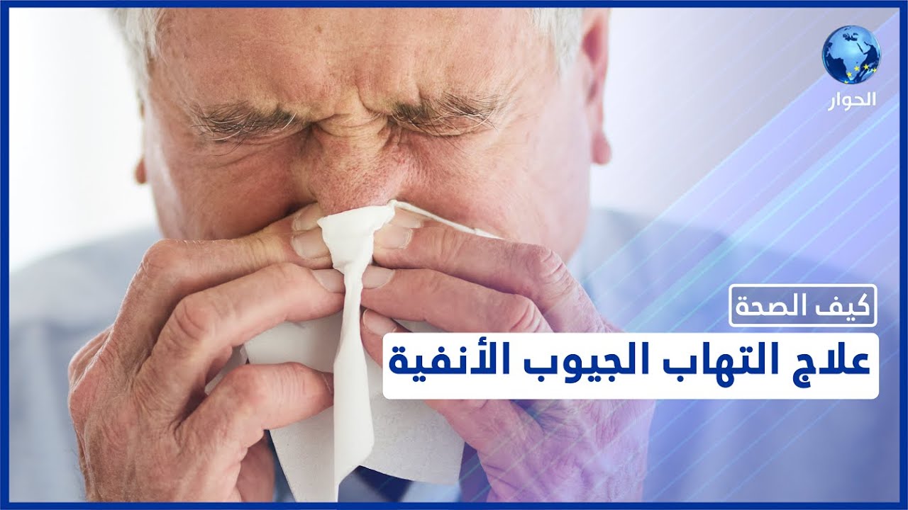 التهاب الجيوب الأنفية.. الأسباب والأعراض وطرق العلاج! - YouTube