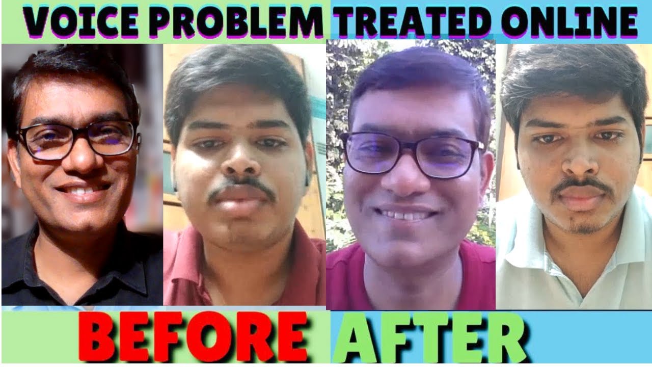 Pre-Post Online Speech Therapy | SLP Sanjay Kumar, AIIMS Delhi Alumnus | Success Story | Since 2010
