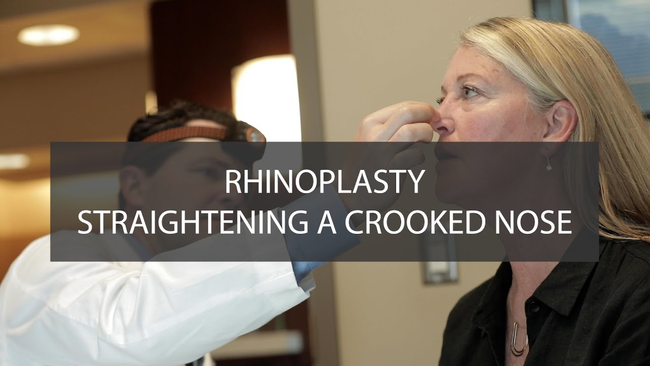 Straightening A Crooked Nose with Rhinoplasty