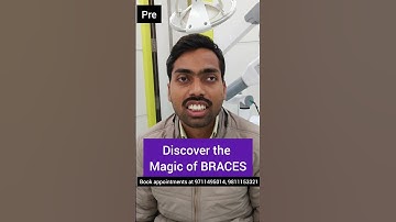 Discover the MAGIC of Braces! Dr. Srishti Bhatia #braces #teeth #orthodontist