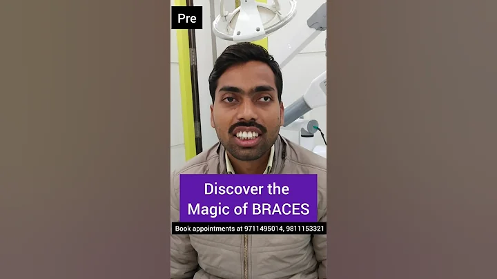 Discover the MAGIC of Braces! Dr. Srishti Bhatia #braces #teeth #orthodontist