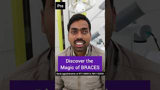 Discover the MAGIC of Braces! Dr. Srishti Bhatia #braces #teeth #orthodontist