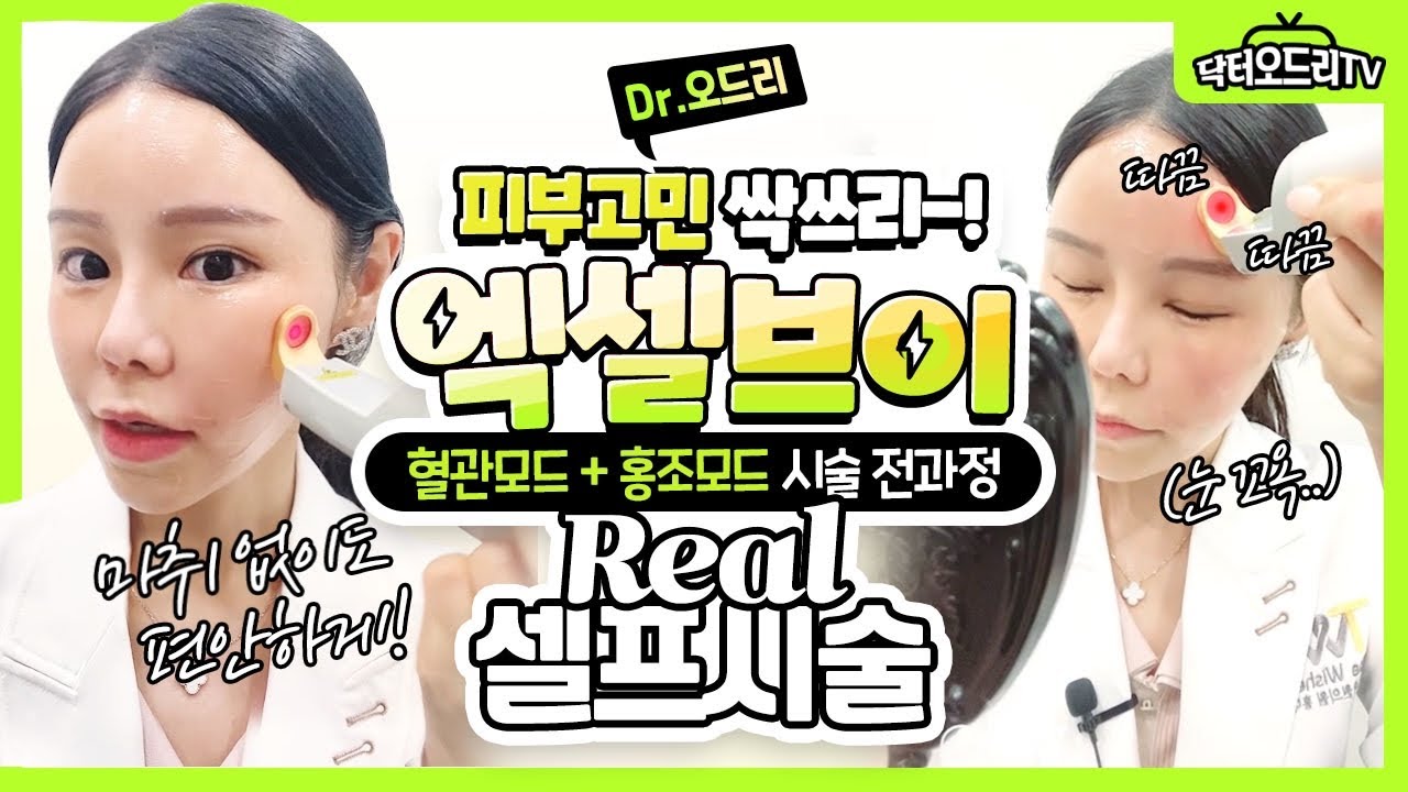 닥터오드리의 셀프시술 : 엑셀브이레이저 혈관모드 & 홍조모드 전 과정이 궁금하시다면?! 꼭 봐주세요~