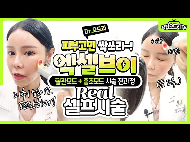 닥터오드리의 셀프시술 : 엑셀브이레이저 혈관모드 & 홍조모드 전 과정이 궁금하시다면?! 꼭 봐주세요~