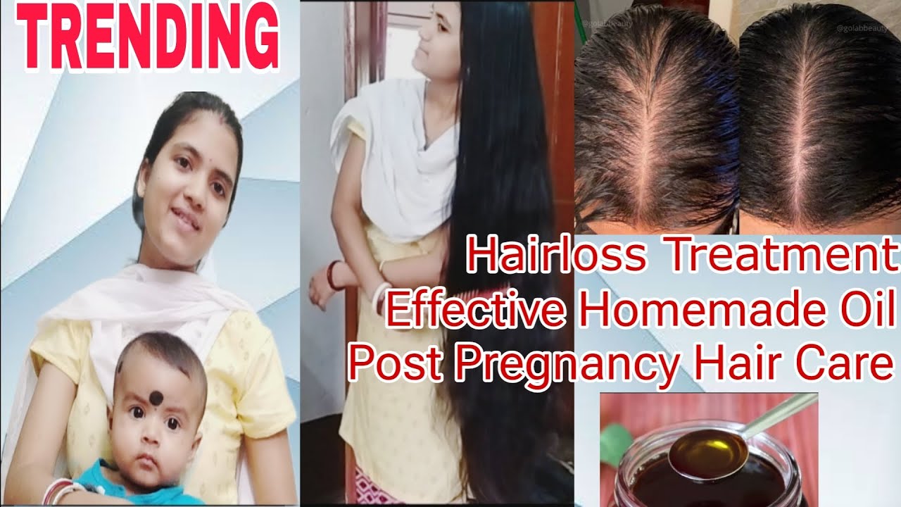 How to treat HairlossHair Loss & Post Pregnancy Hair Treatmentচুল ওঠা