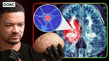 The #1 SIMPLE Way Your Brain Tricks You Every Day