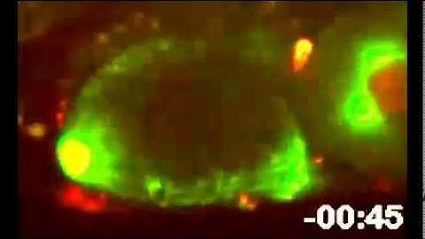 The KLP-7 Residue S546 Is a Putative Aurora Kinase Site Required for Microtubule Regulation...