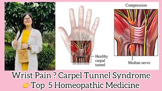 Wrist Pain Top Homeopathic Medicine? Carpel Tunnel Syndrome Best Homeopathic Treatment? - Dr Rukmani