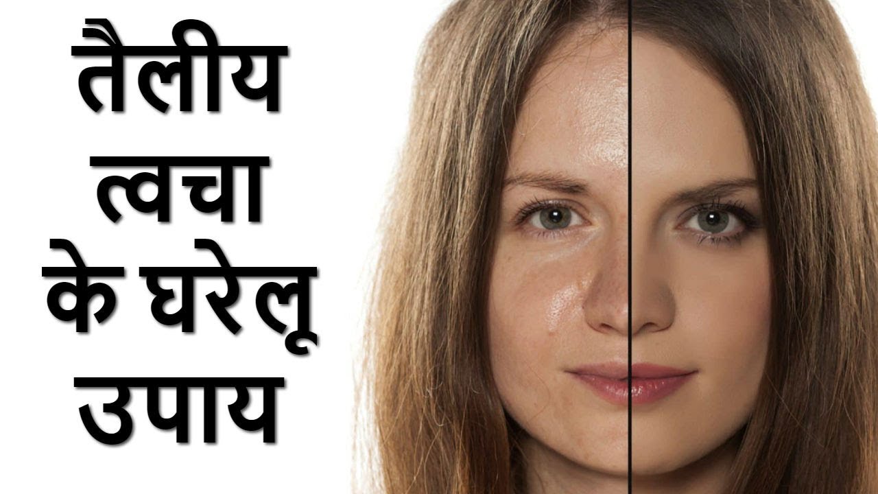 Home Remedies for Oily Skin in Hindi तैलीय त्वचा से छुटकारा पाने के