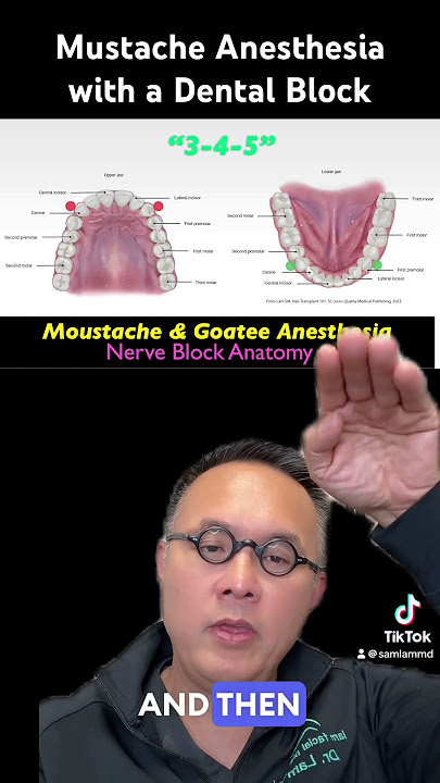How to Achieve Mustache & Goatee Anesthesia in Hair Transplant Surgery