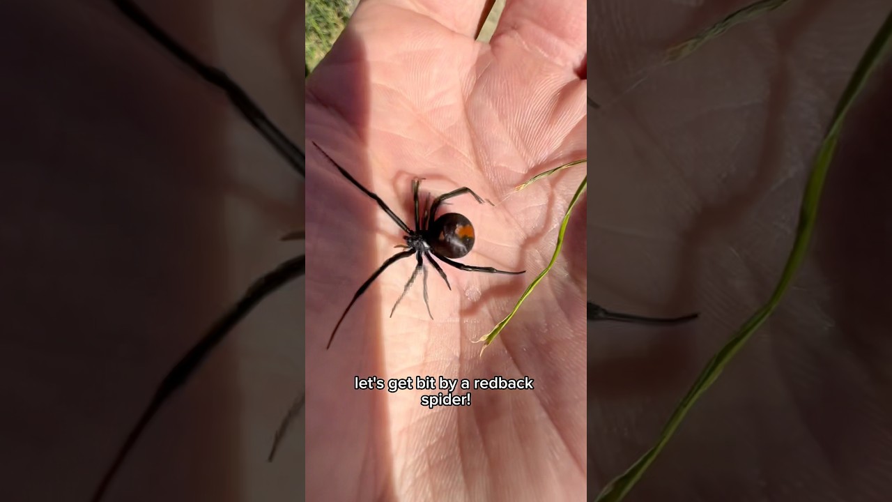 I GOT BIT BY A REDBACK SPIDER! 