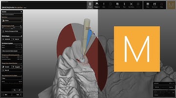 How to tilt screw channels in Zirkonzahn.Modellier | Zirkonzahn.Software