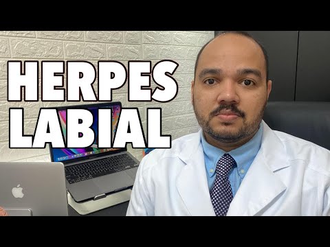 Vídeo: Como saber se você tem herpes oral (com fotos)