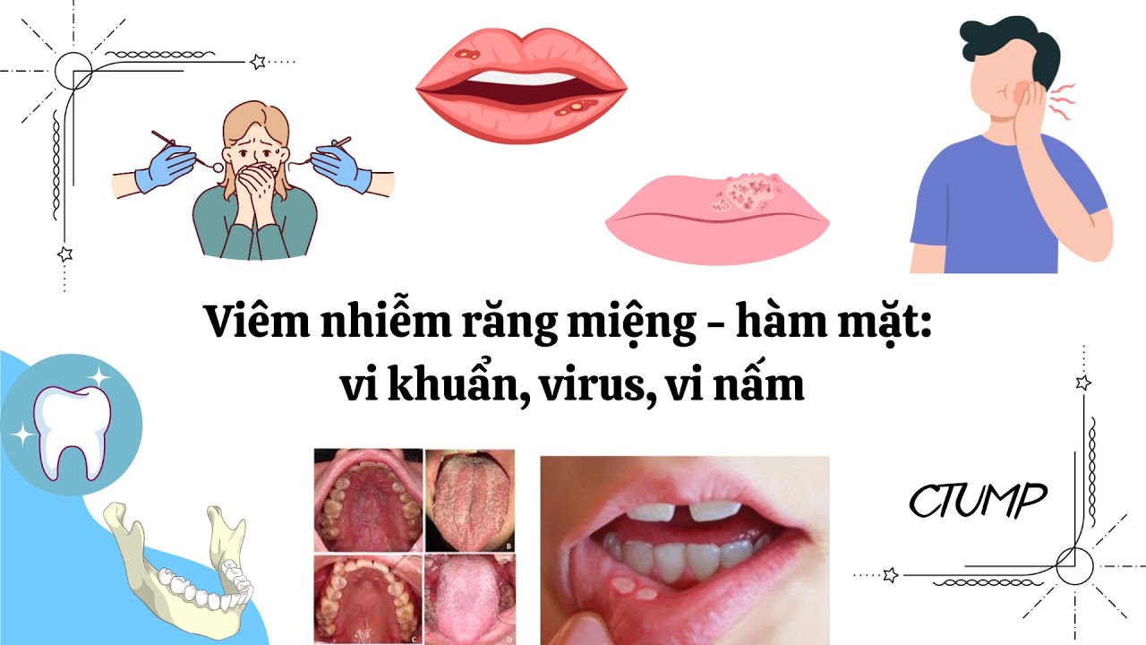 [RĂNG HÀM MẶT] - Bài 4: Viêm nhiễm răng miệng - hàm mặt: vi khuẩn ...