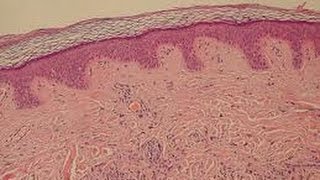 Anatomy And Physiology Of The Dermis