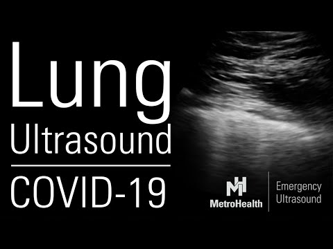 Lung Ultrasound for COVID-19