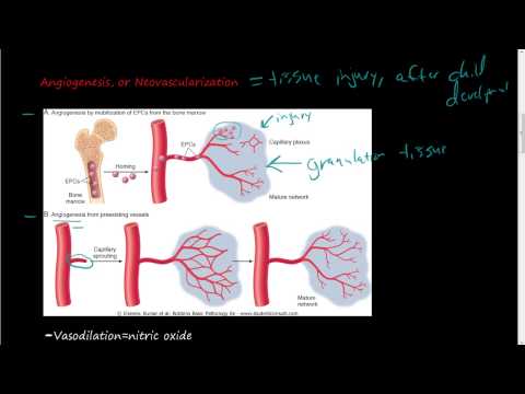 Video: Ar angiogenezė yra tas pats, kas neovaskuliarizacija?