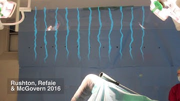 The effect of operating lights on laminar flow