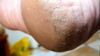 My Barefeet & Special Soles