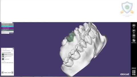 Infinitech Academy - Exocad Coping mirror workflow